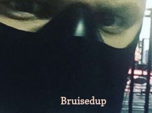 Bruisedup